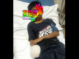 中学生玩爆竹被炸伤  切除右掌保命