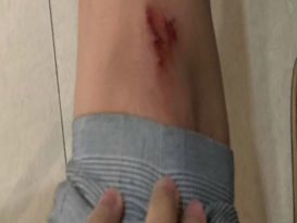 男子假Minta Tolong真掠夺  妇女住家前被抢手袋