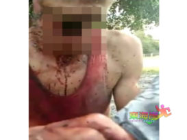 涉群殴 遭挥刀 男子险被砍断脖子