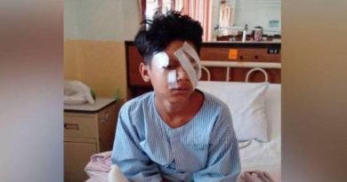 少年遭炸断手指眼受伤 “    很后悔，不敢玩鞭炮了！”