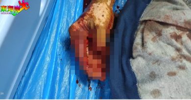 鹊鸟失窃 饲主遭3男攻击 头破拇指断