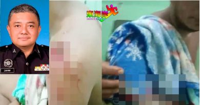 老虎咬断外劳手  不是在云顶发生