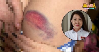 学生因穿错校服遭鞭伤 曾梦茜：务必追责涉事教师