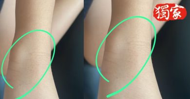 独家｜女童跳舞频出错     被打    舞蹈老师被警扣留协查